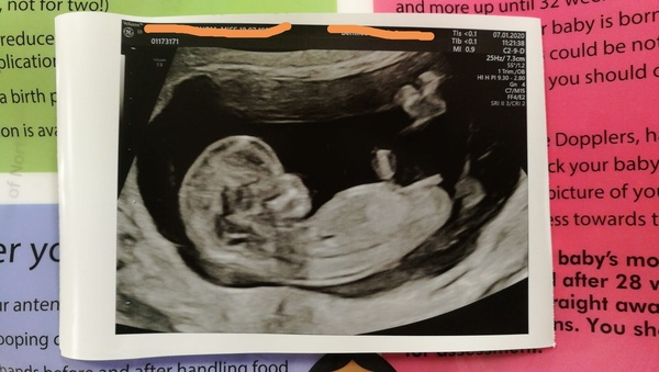 Boy or girl?