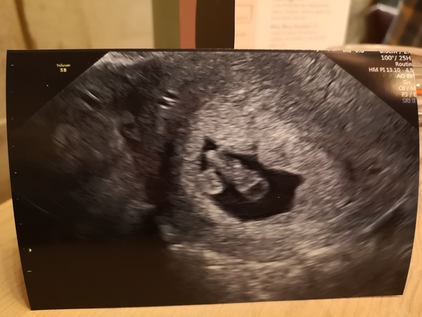 Scan photos at 7-8 weeks please