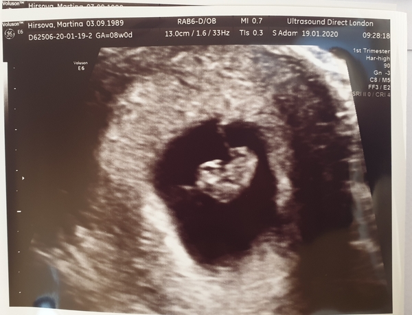 BFP! August/September 2020 Babies!