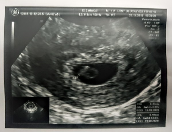 Anyone due August 2020 pt II