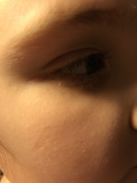 Did you have a forceps birth?