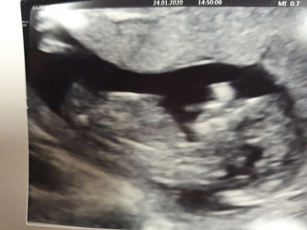 Nub theory 12 weeks