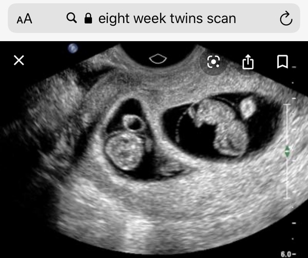 Private scan called me to say they made a mistake