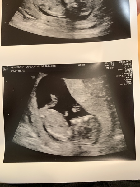 Anyone due August 2020 pt II