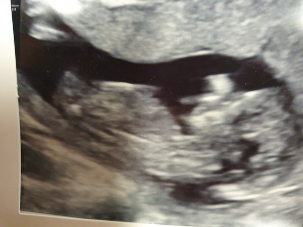 Nub theory 12 weeks