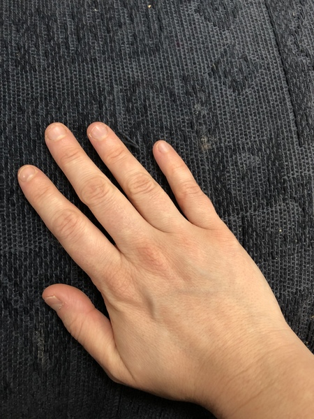 Anyone managed to stop biting their nails? How?