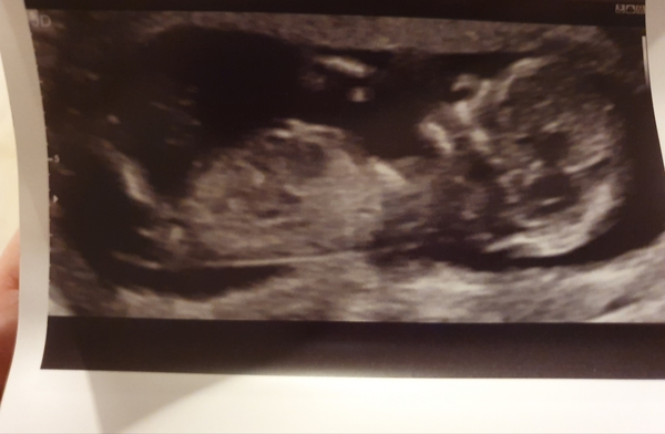 Just for fun - gender guesses!