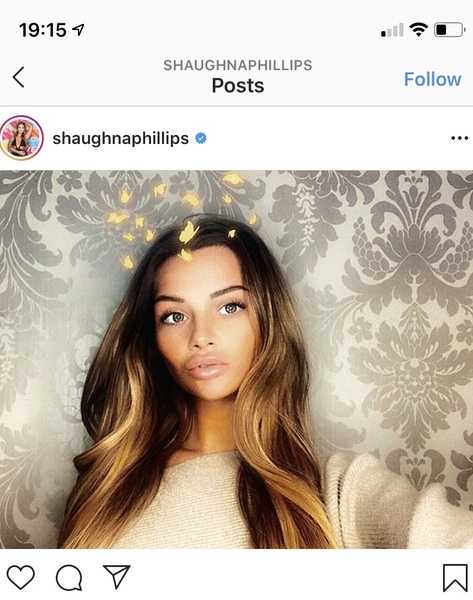 Love Island - Connorteeth Bites Back!