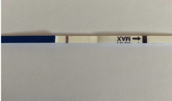 Line eyes - 12 DPO squinter or indent?
