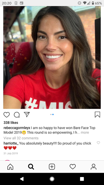 Love Island - Connorteeth Bites Back!