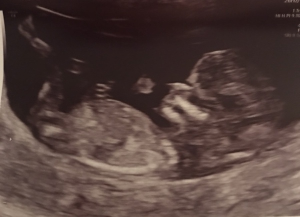 Had my 12 week scan. Any gender guesses?