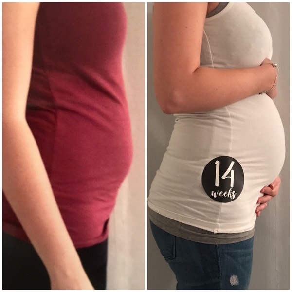 Abnormally large bump?
