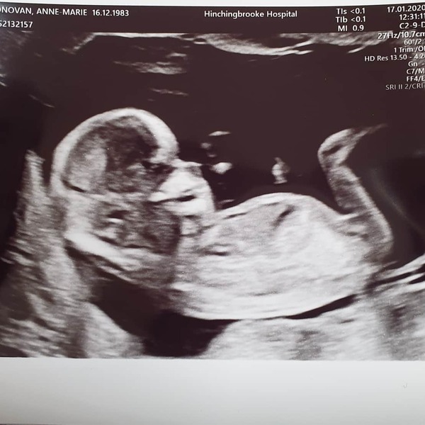 Boy or girl fun - 13 week scan