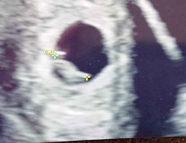 I'm 6 weeks pregnant, it's Going so slow!