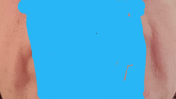 What are these lines called and how can I get rid of them quickly?