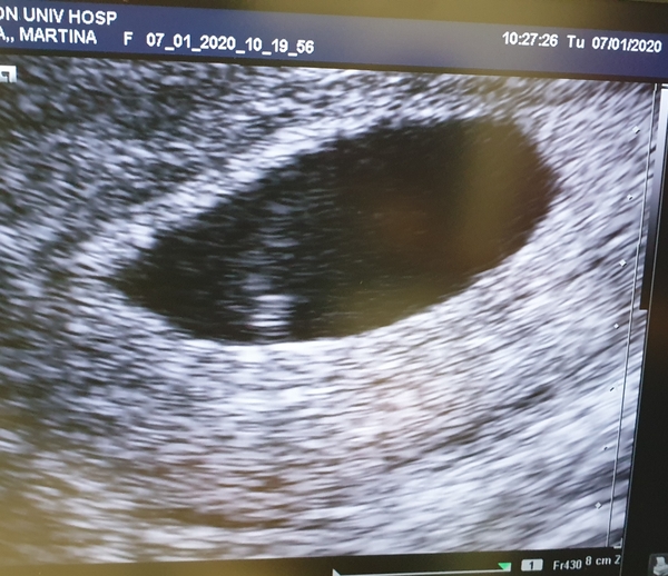 BFP! August/September 2020 Babies!