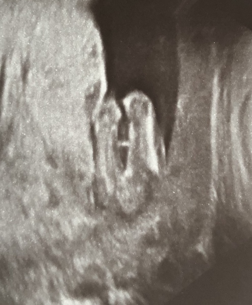 Due June 2020: Thread 3