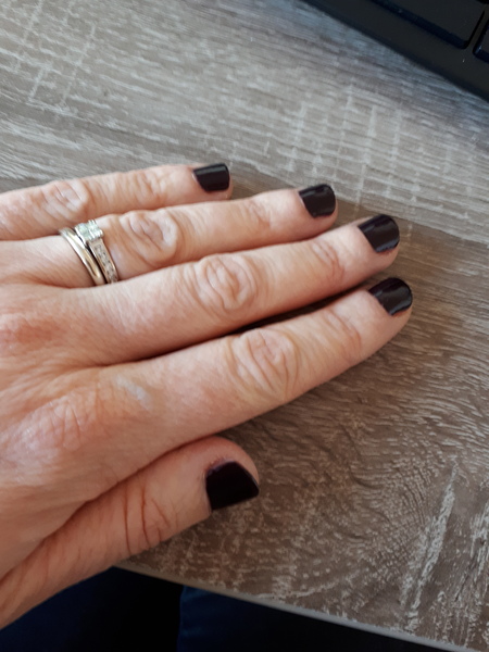 Nail biting