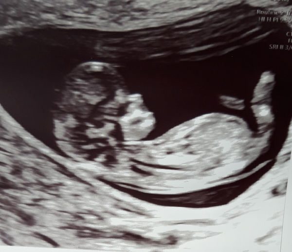 Anyone due August 2020 pt II