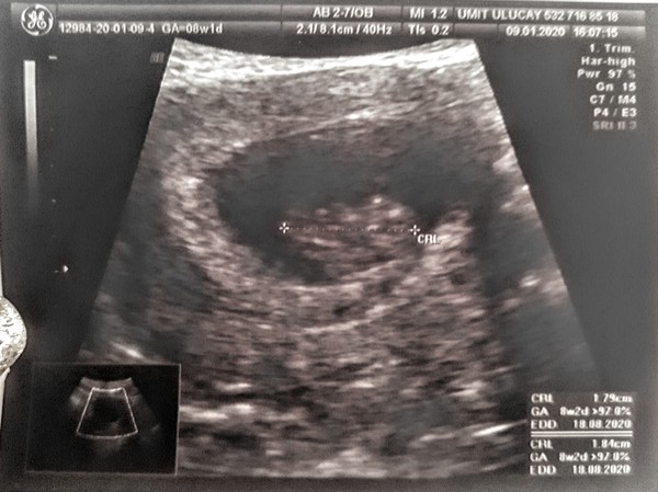 Anyone due August 2020 pt II