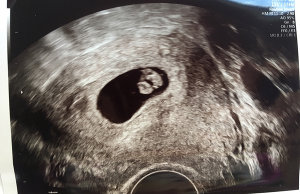 Scan photos at 7-8 weeks please