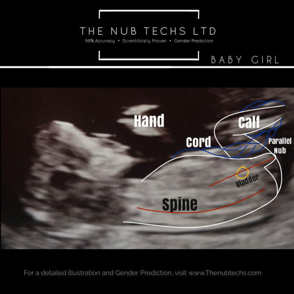 Nubtech reviews