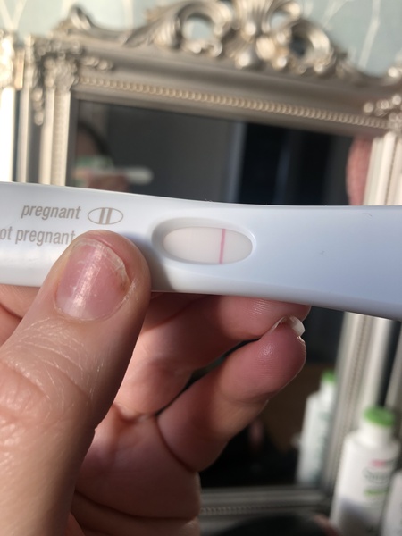 FRER disappearing line