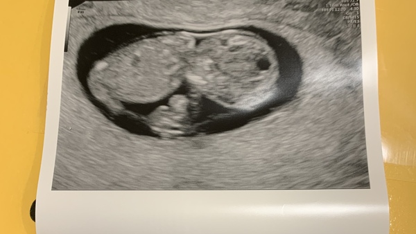 Anyone due August 2020 pt II