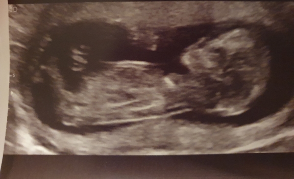 Just for fun - gender guesses!