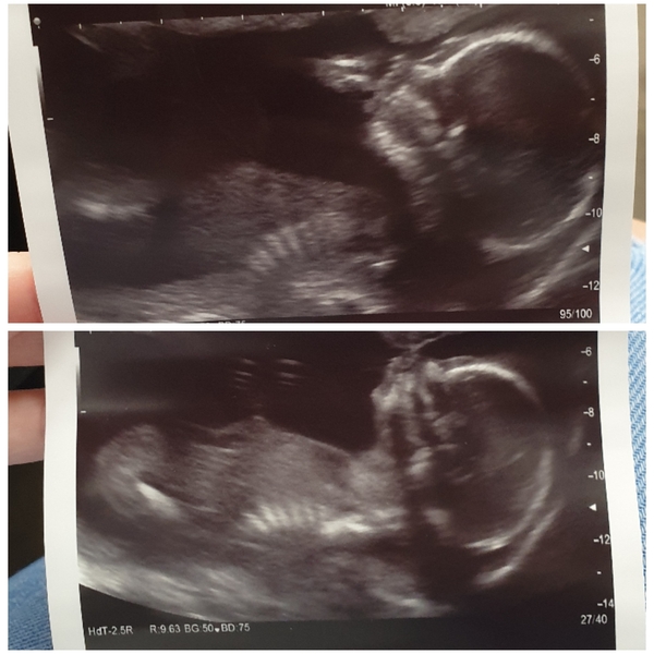 Due June 2020: Thread 4