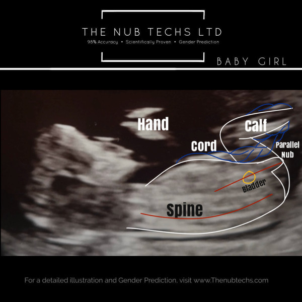 Nub Techs experience?