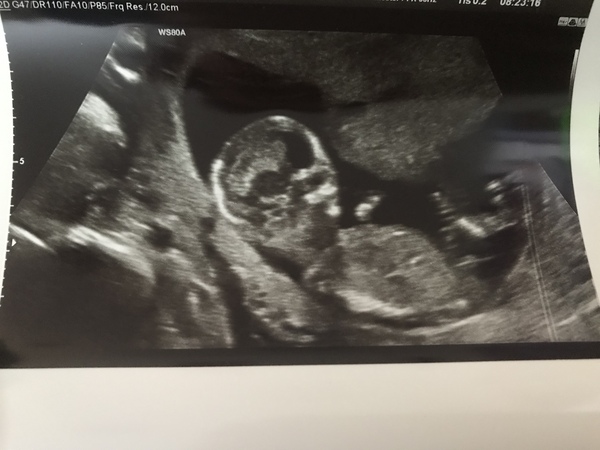 13+3 scan, nub theory 😊