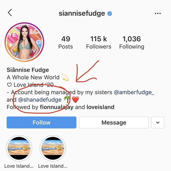 Love Island - Connorteeth Bites Back!