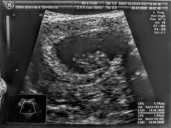 Scan photos at 7-8 weeks please