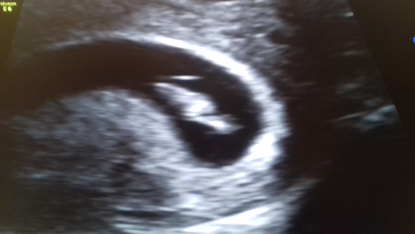 Scan photos at 7-8 weeks please