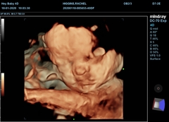 Due March 2020 - FIRST BABY in late 20's