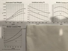 Doppler measurements off charts at 31 weeks. Should I be concerned?