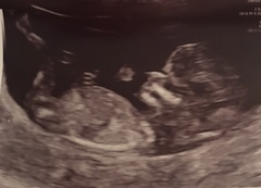 Gender guesses! Humour me!