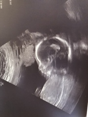 Due May 2020 (Thread 4)