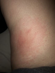 What is this?