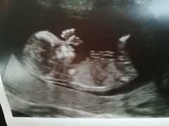 Boy or Girl?