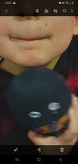 Mouth and Lips