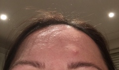 Help me sort my skin out...please