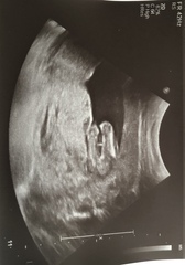 Due June 2020: Thread 3