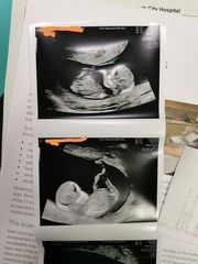Nub theory pleaseeee 12 weeks!