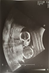 Due June 2020: Thread 3