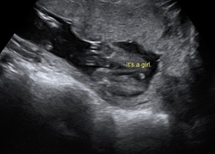 Gender scan sexing wrong?