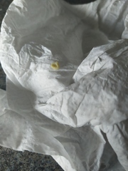 Sorry gross out klaxon! Any dentist around to help?
