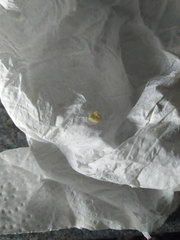 Sorry gross out klaxon! Any dentist around to help?