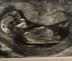 Boy or girl?